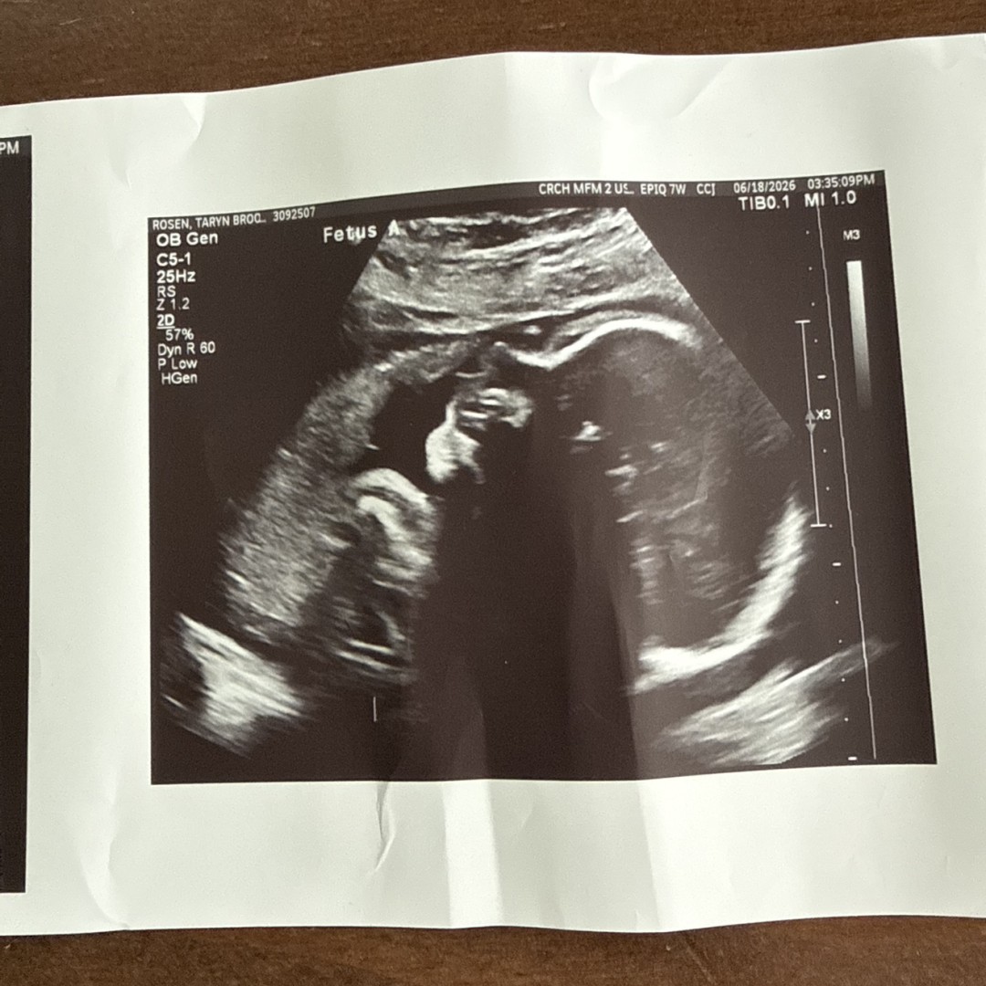 Photo shared by Taryn for their Babylist baby registry.