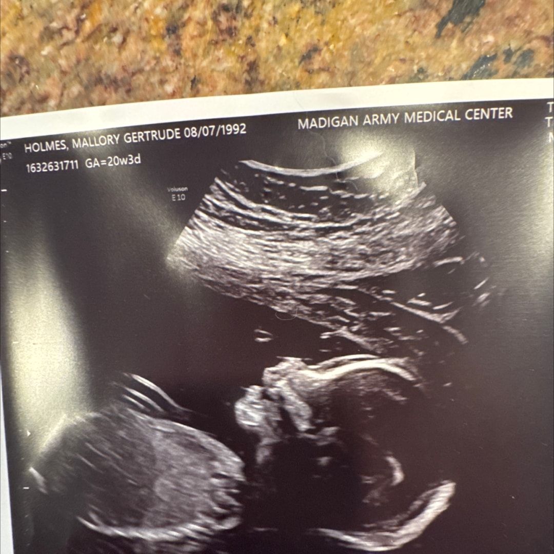 Photo shared by Mallory for their Babylist baby registry.