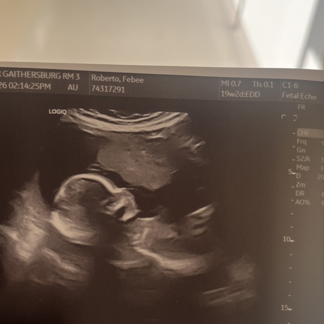 Photo shared by FEBEE for their Babylist baby registry.