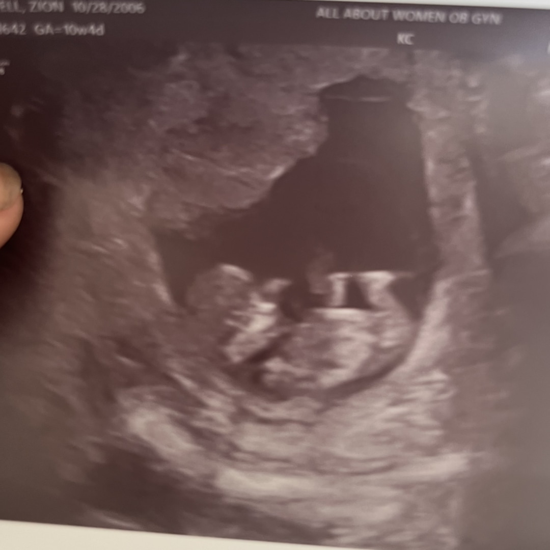 Photo shared by Zion for their Babylist baby registry.