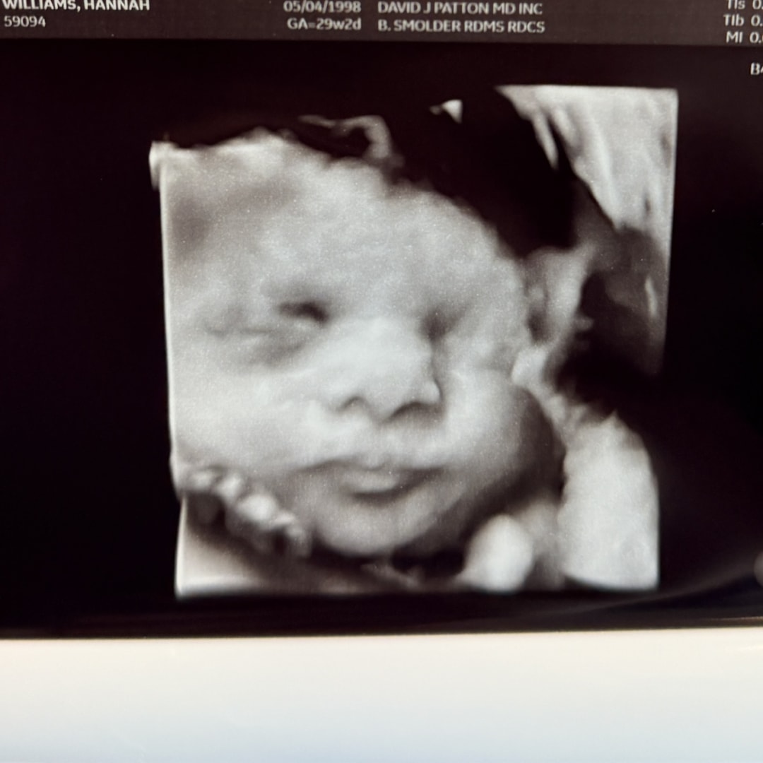 Photo shared by Hannah for their Babylist baby registry.