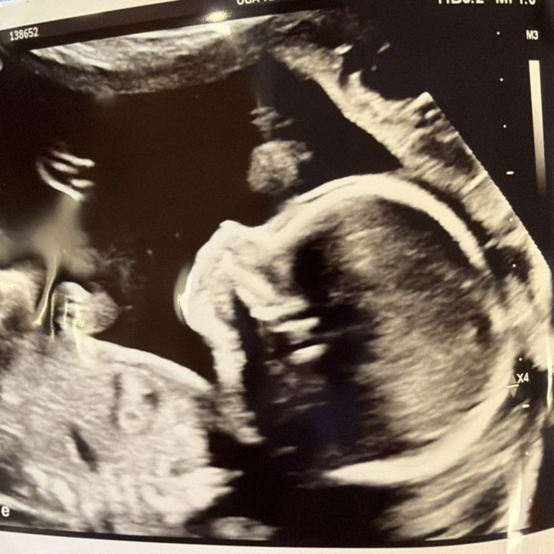 Photo shared by Lauren for their Babylist baby registry.