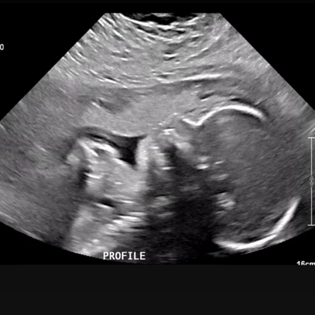 Photo shared by Briana for their Babylist baby registry.