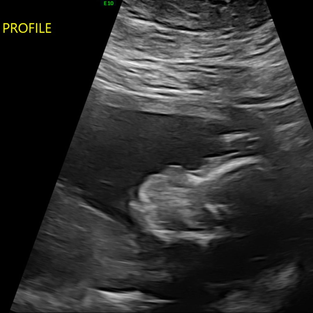 Photo shared by Madison for their Babylist baby registry.