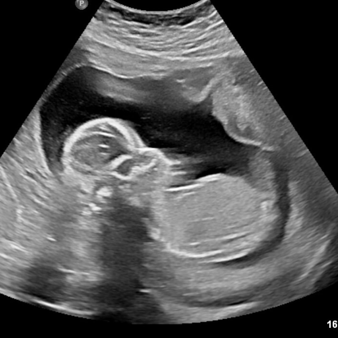 Photo shared by Brittney for their Babylist baby registry.