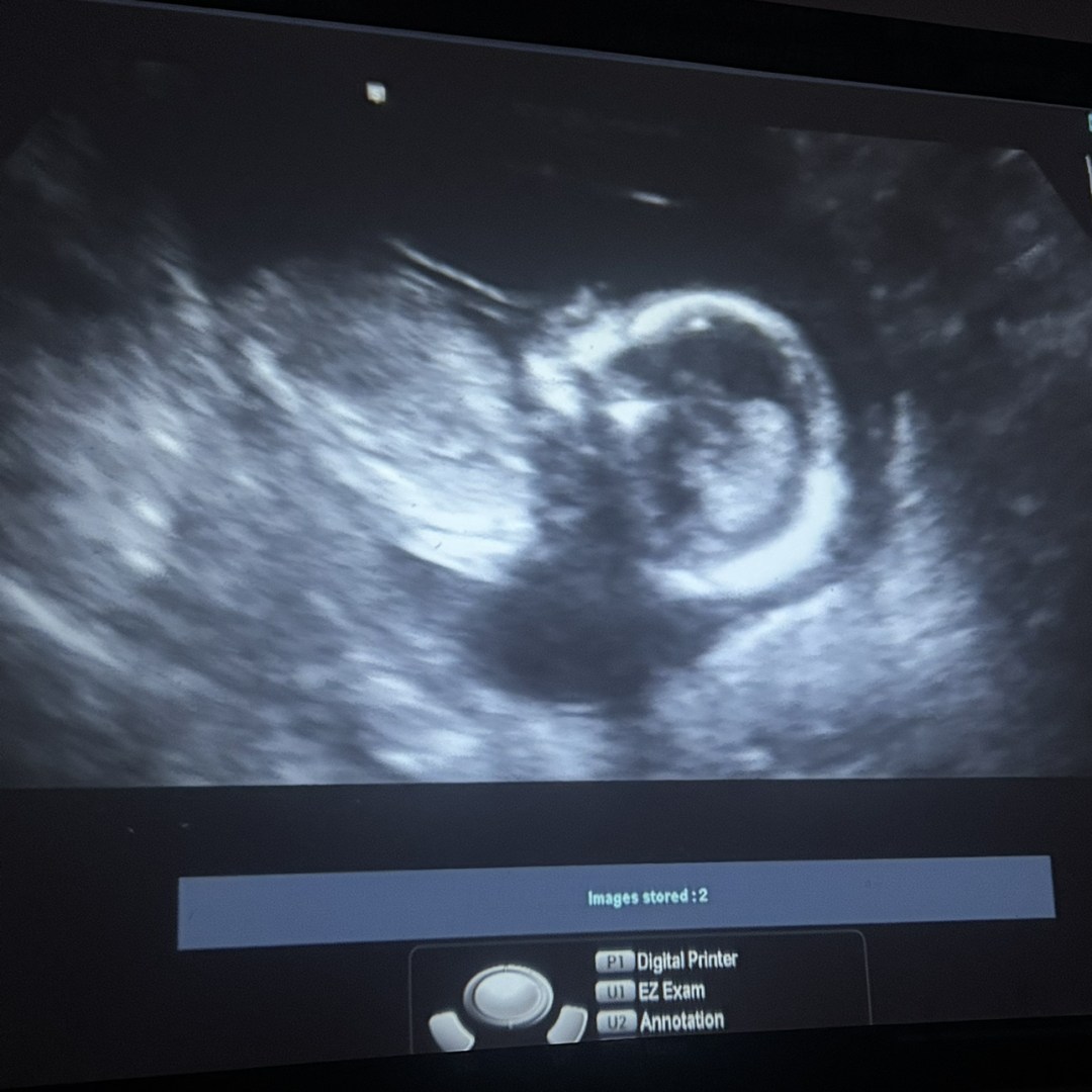 Photo shared by Brianna Mejia for their Babylist baby registry.
