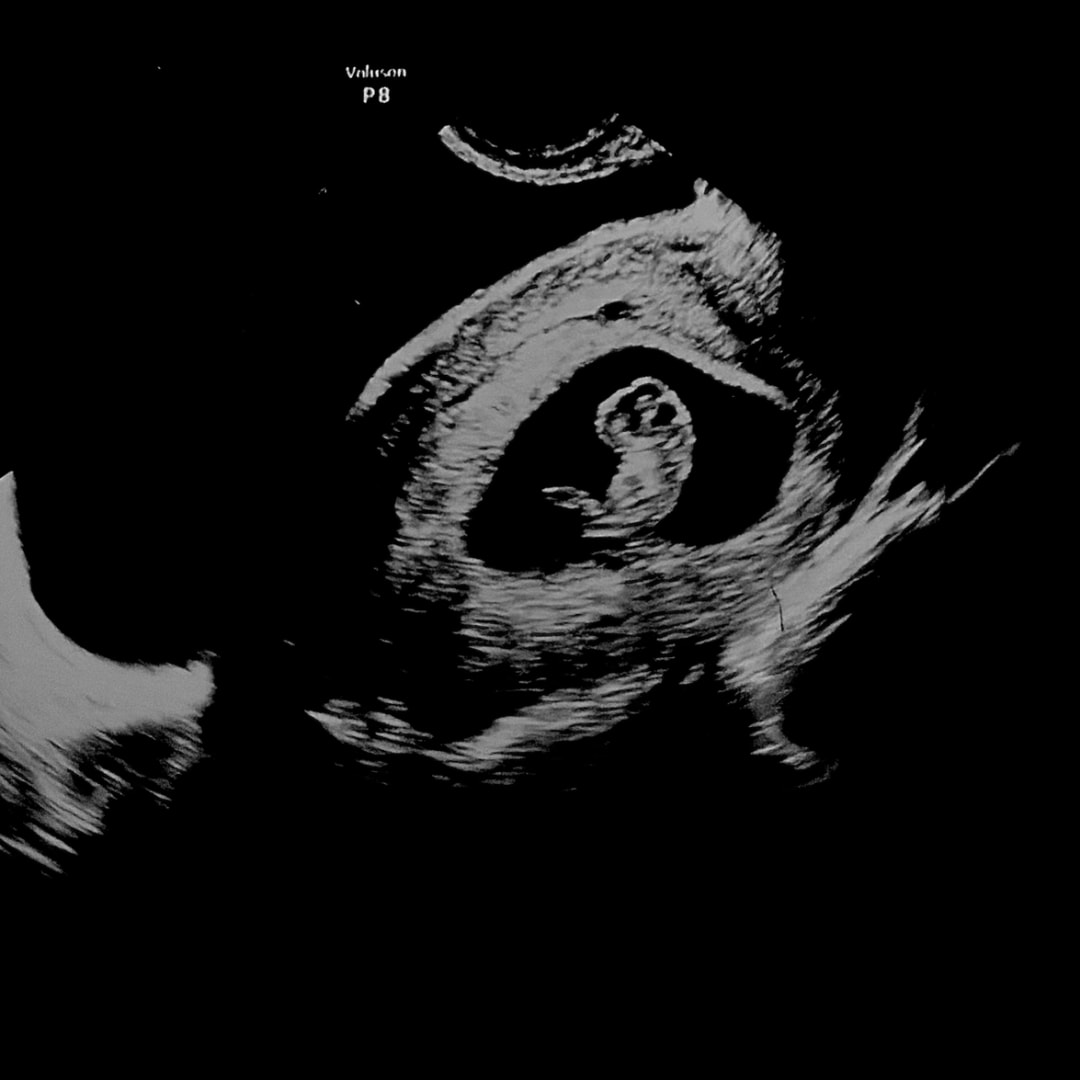 Photo shared by Tara for their Babylist baby registry.