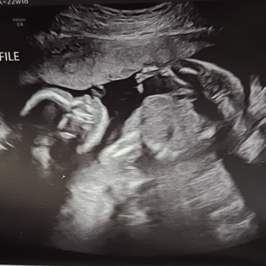 Photo shared by Felicia for their Babylist baby registry.