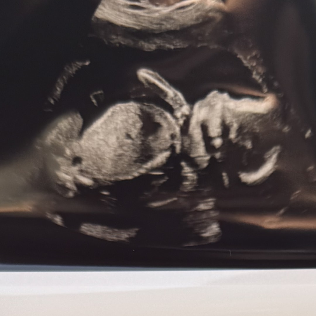 Photo shared by Candie for their Babylist baby registry.