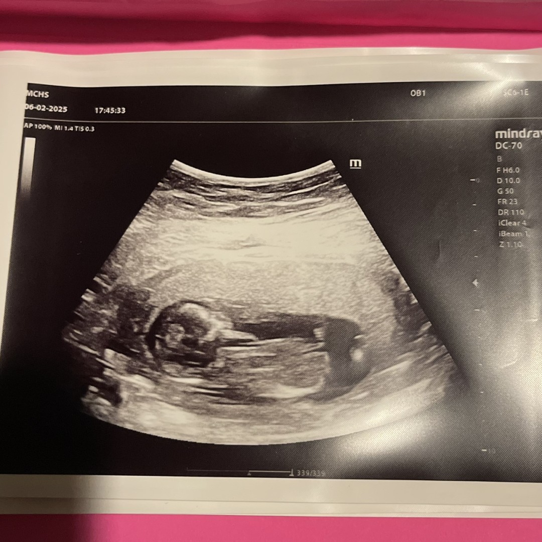 Photo shared by Josie for their Babylist baby registry.