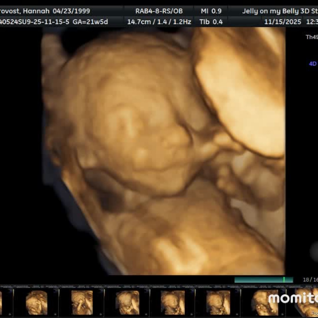 Photo shared by Hannah for their Babylist baby registry.