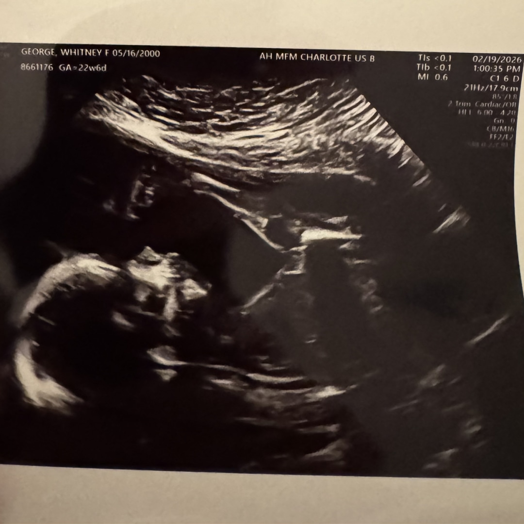 Photo shared by Whitney for their Babylist baby registry.