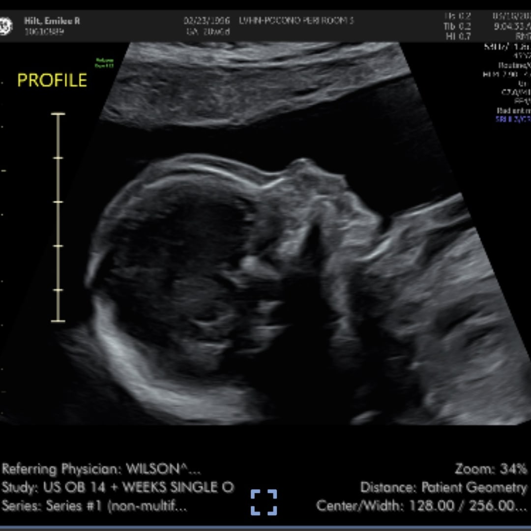 Photo shared by Emilee for their Babylist baby registry.