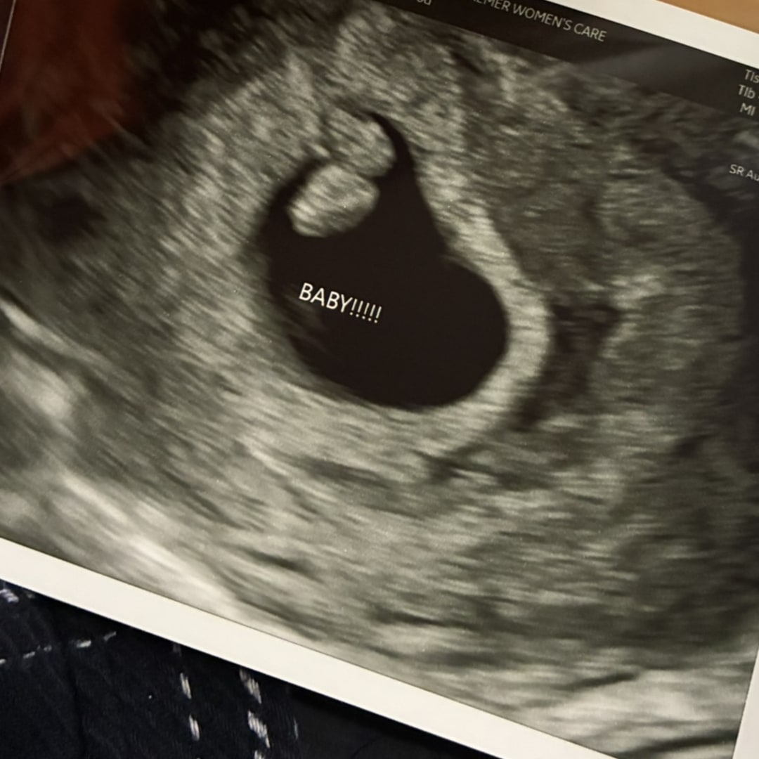 Photo shared by Ashley for their Babylist baby registry.