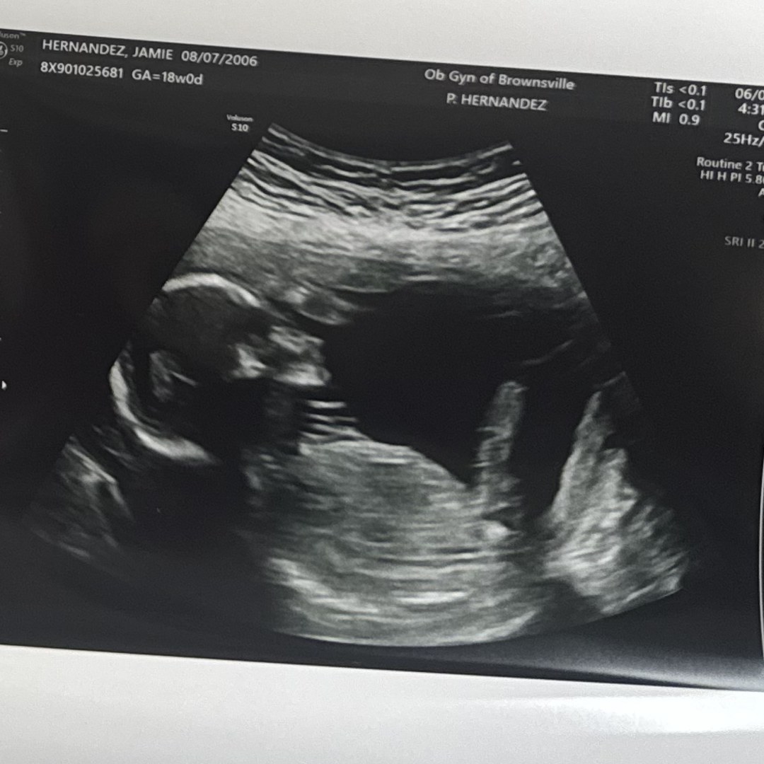 Photo shared by Jamie for their Babylist baby registry.