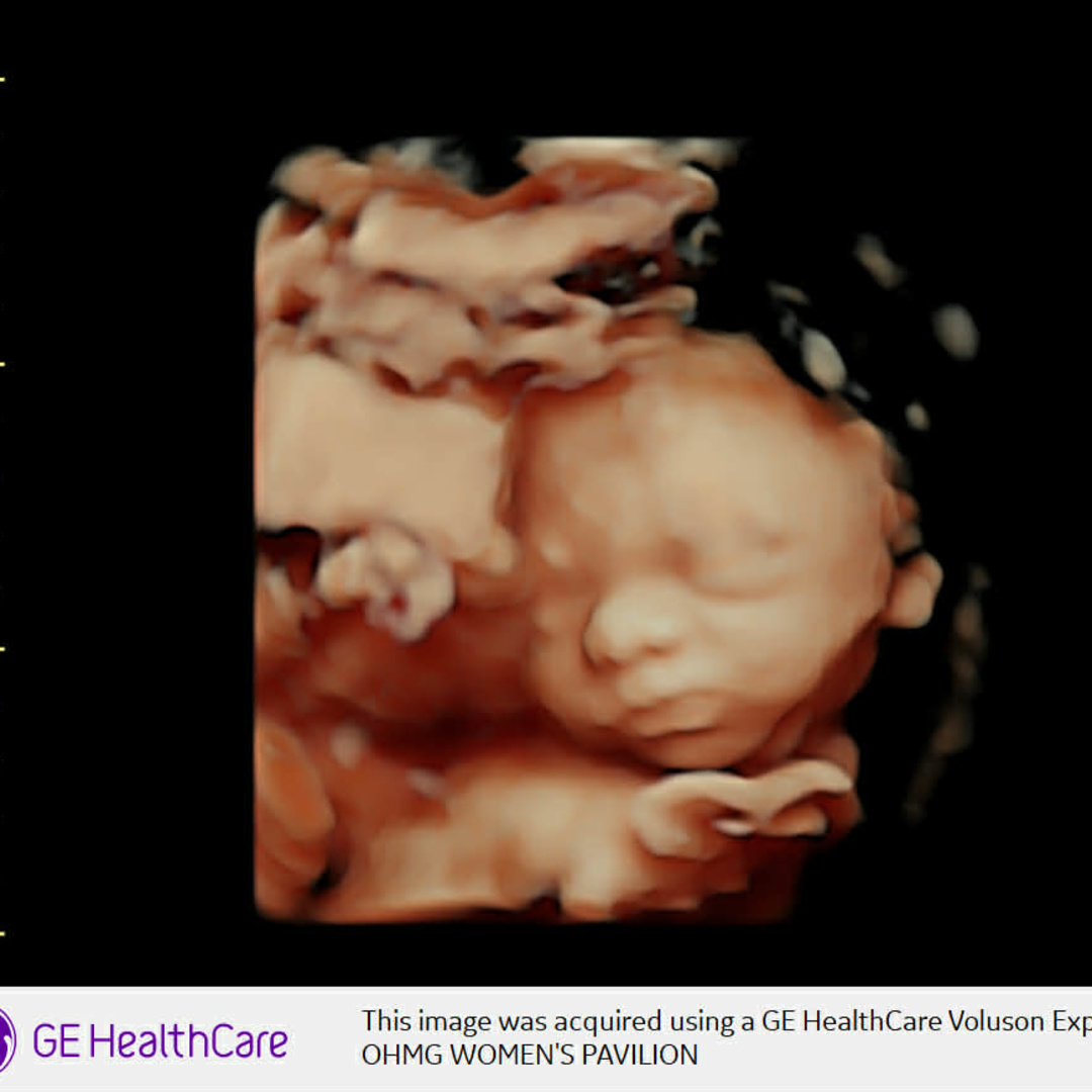 Photo shared by Emily for their Babylist baby registry.