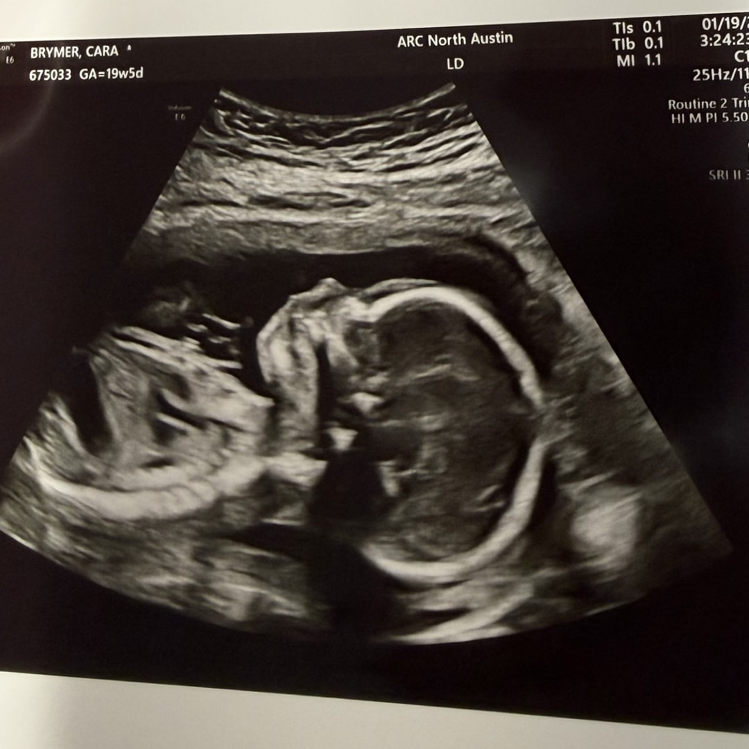 Photo shared by Cara for their Babylist baby registry.