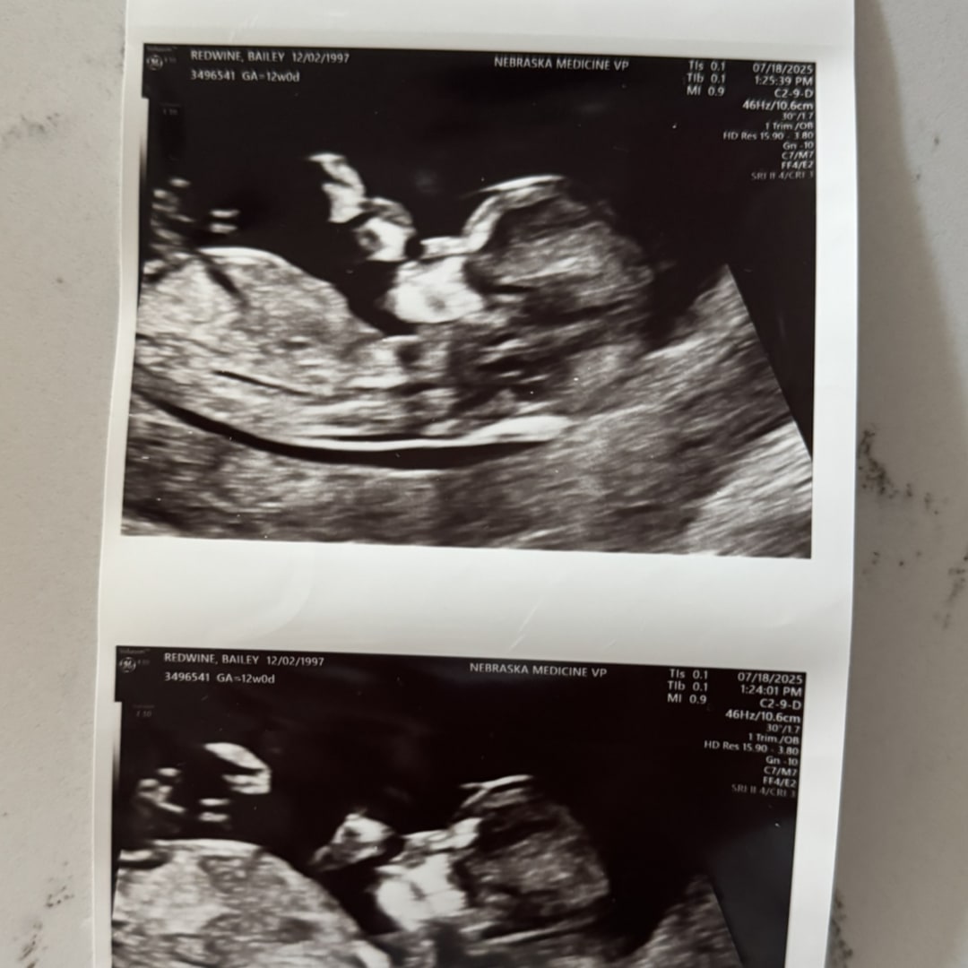 Photo shared by Bailey for their Babylist baby registry.
