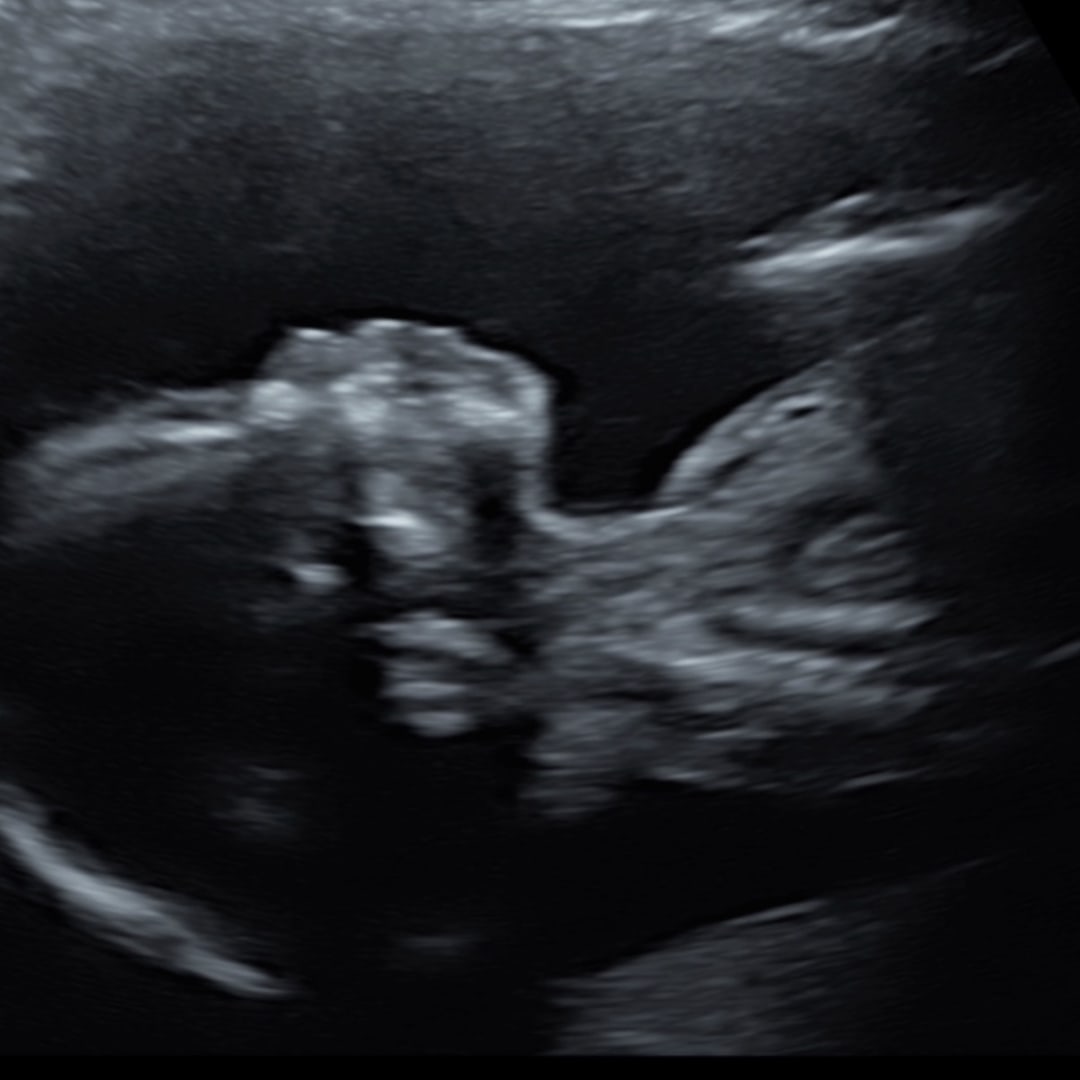 Photo shared by Morgan for their Babylist baby registry.
