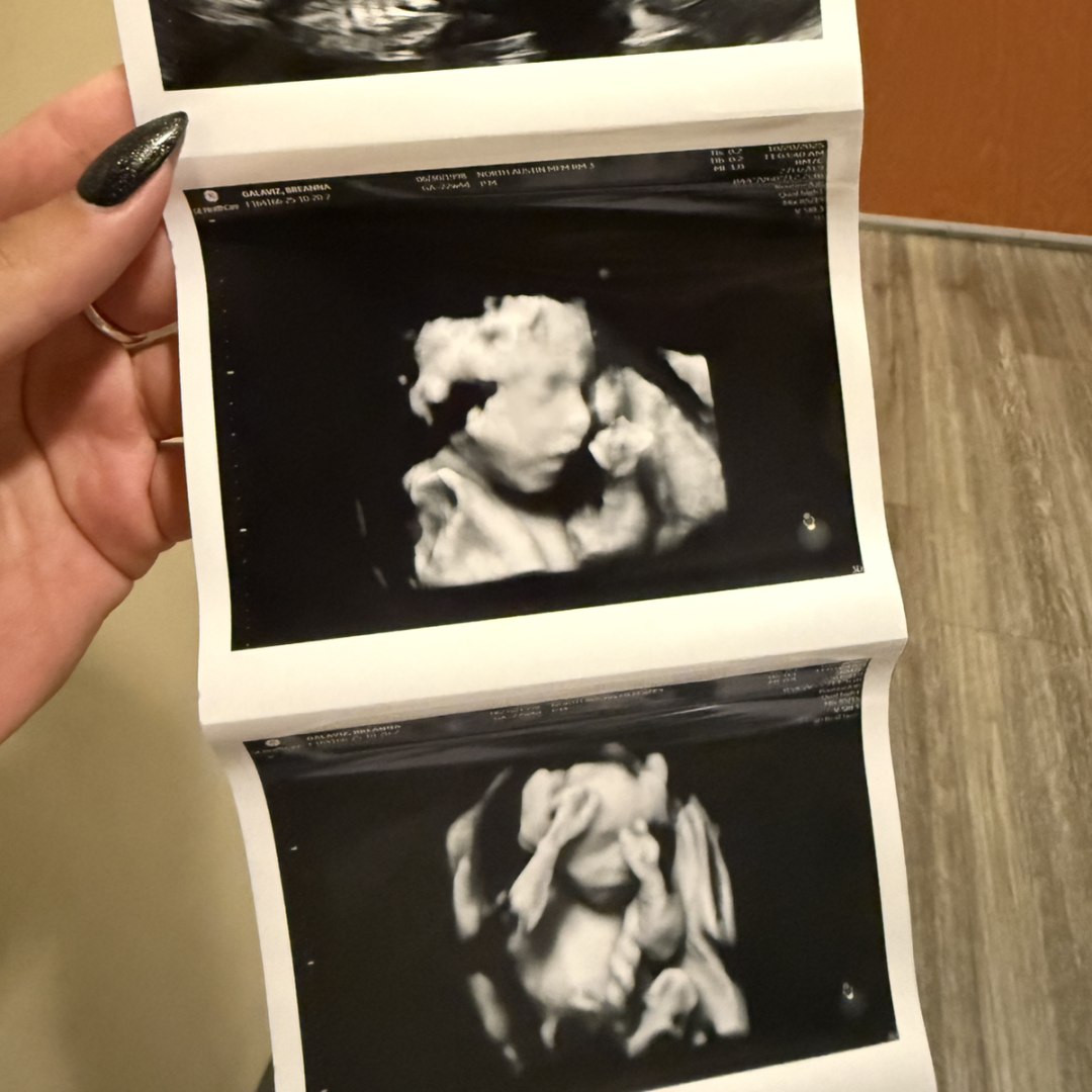 Photo shared by Breanna for their Babylist baby registry.
