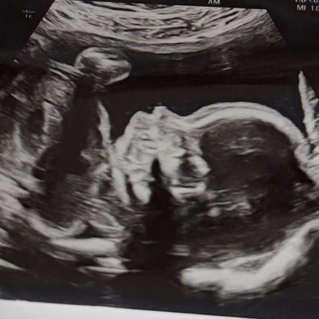 Photo shared by Caylee for their Babylist baby registry.