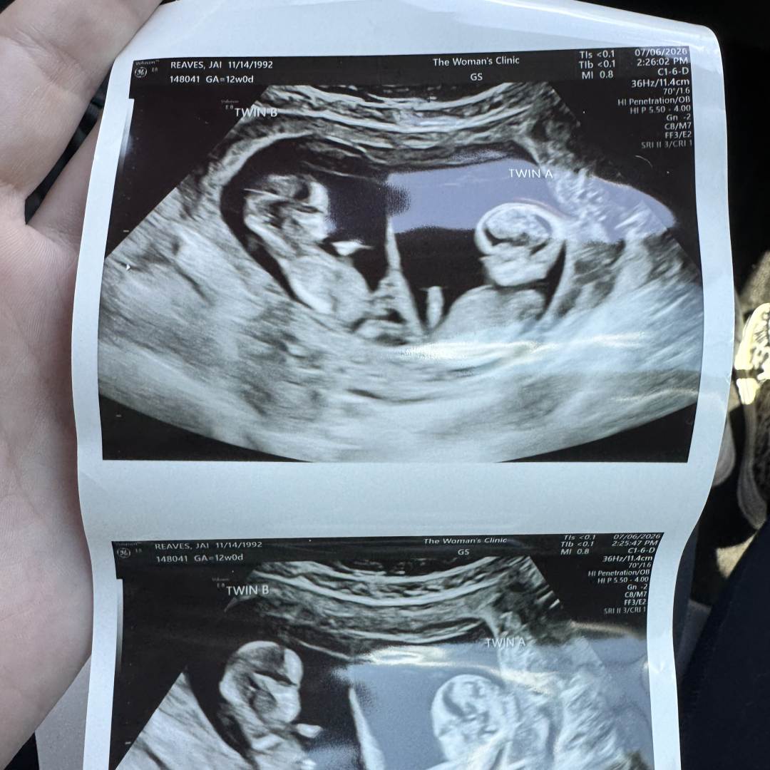 Photo shared by Jai for their Babylist baby registry.