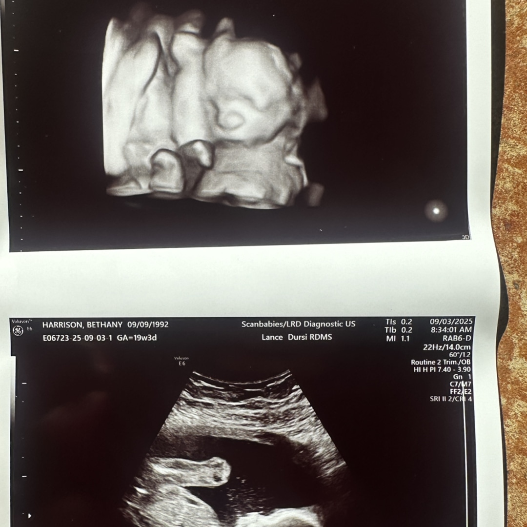 Photo shared by Bethany for their Babylist baby registry.