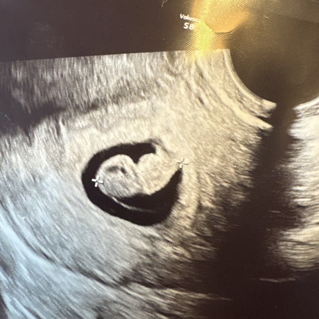 Photo shared by Lizbeth for their Babylist baby registry.