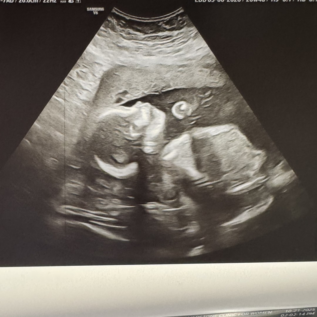 Photo shared by Shannon for their Babylist baby registry.