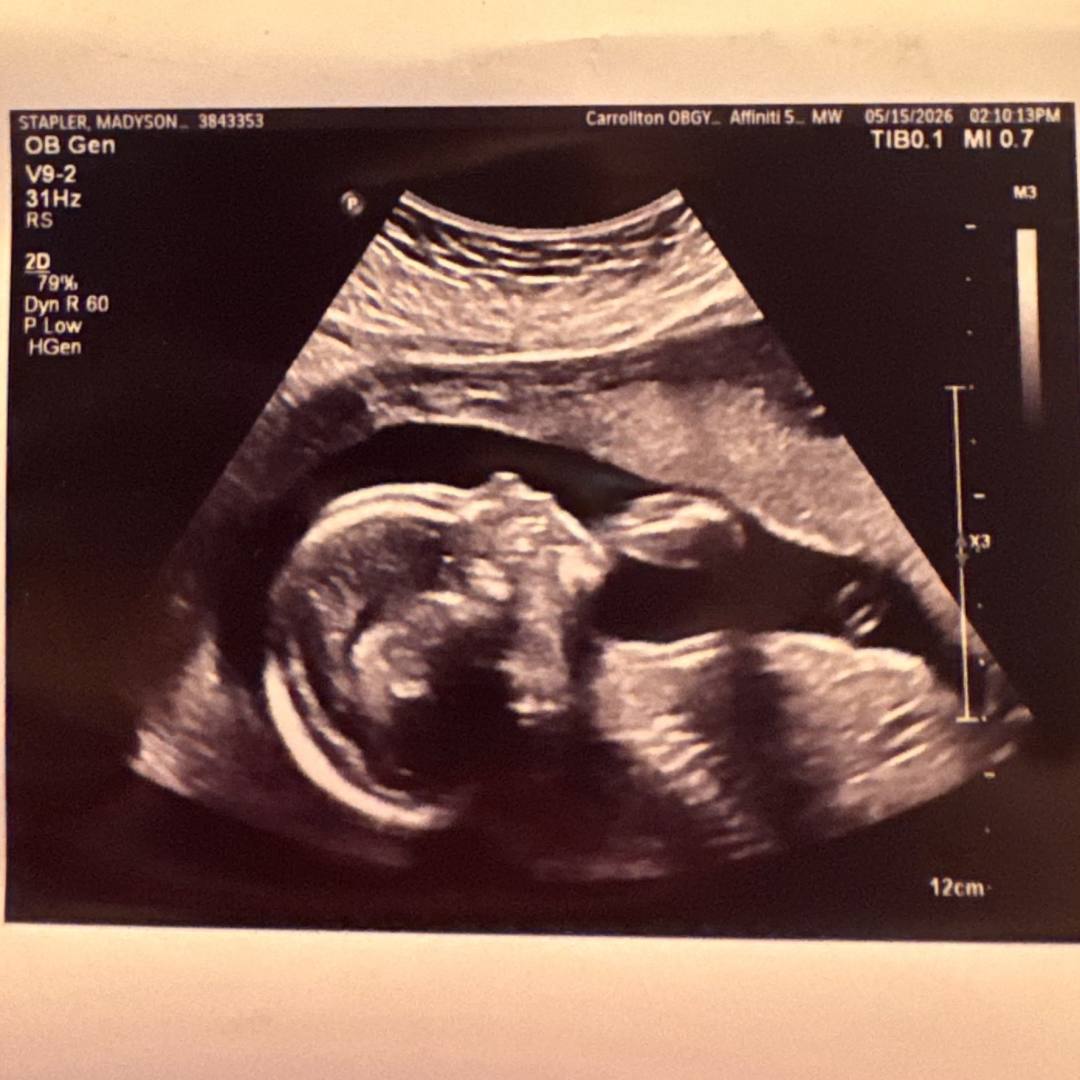 Photo shared by Mady for their Babylist baby registry.