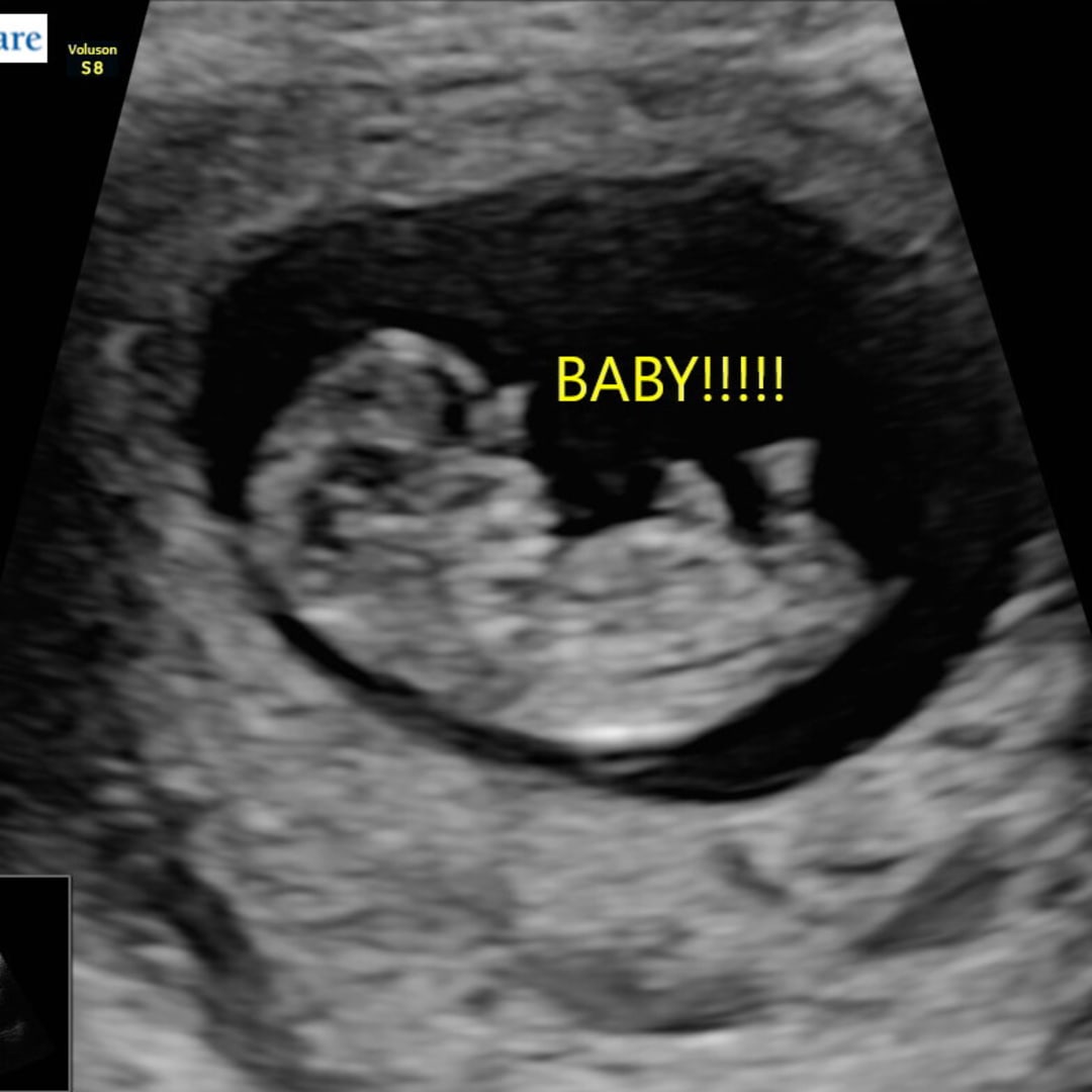 Photo shared by Audrey for their Babylist baby registry.