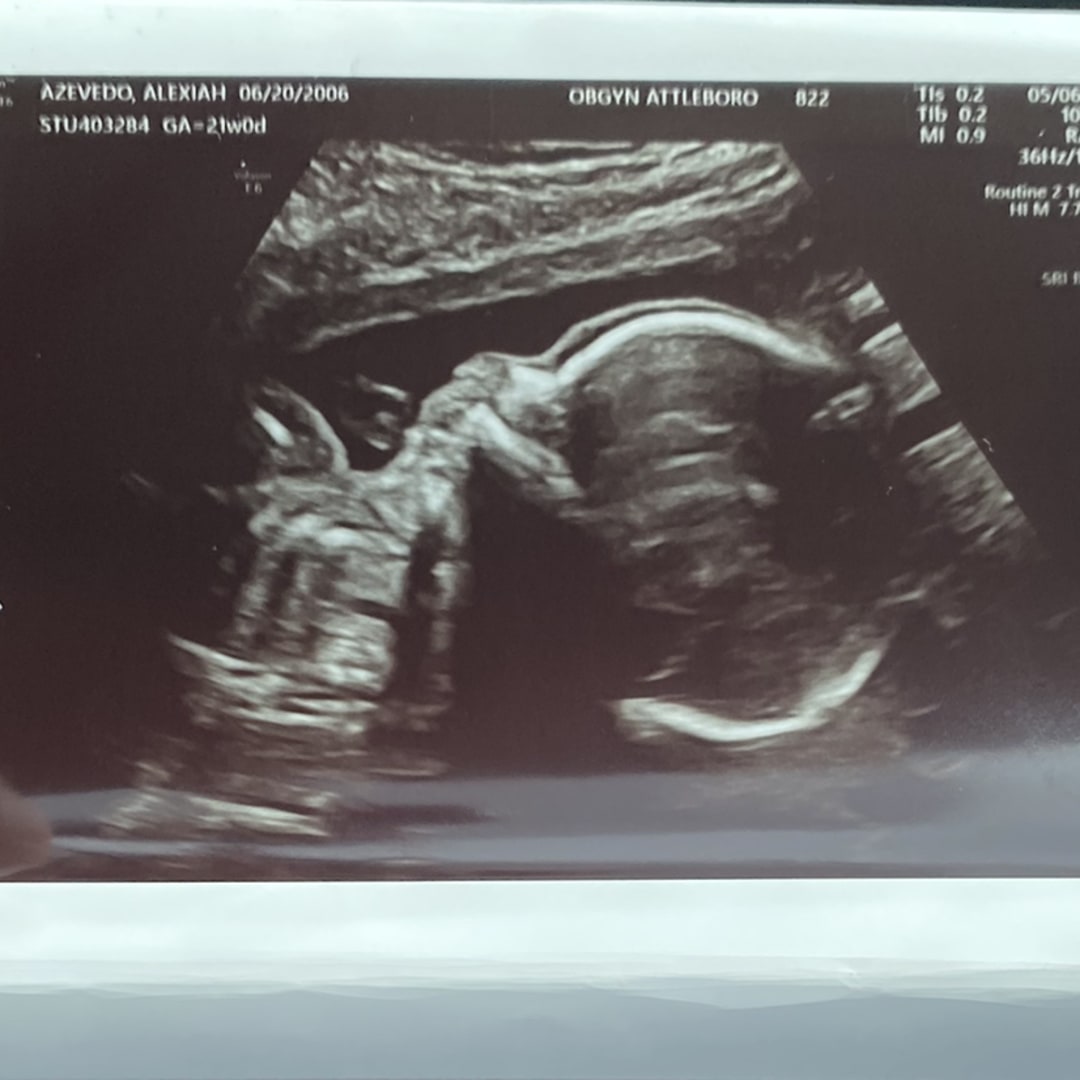 Photo shared by Alexiah for their Babylist baby registry.