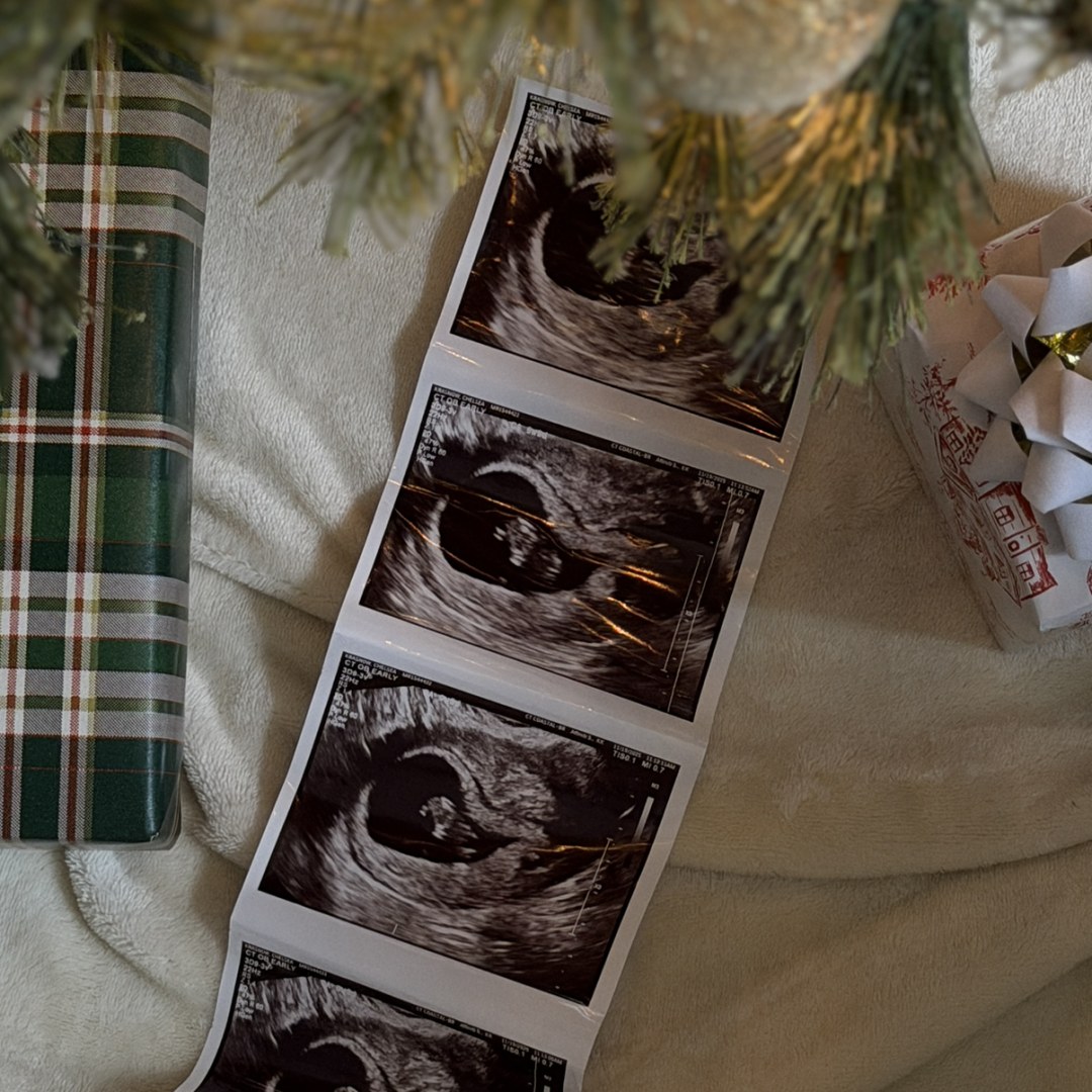 Photo shared by Chelsea for their Babylist baby registry.