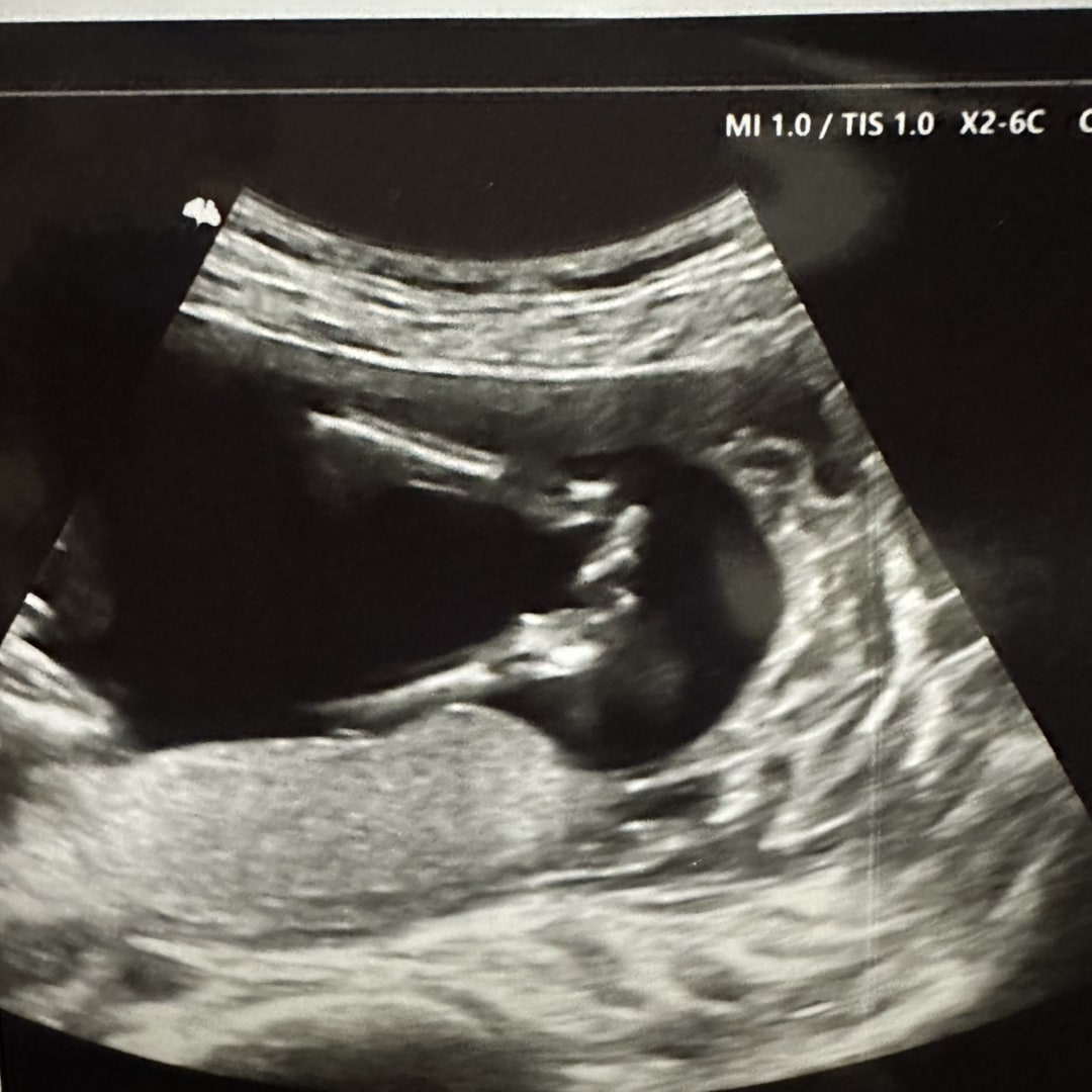 Photo shared by Victoria for their Babylist baby registry.