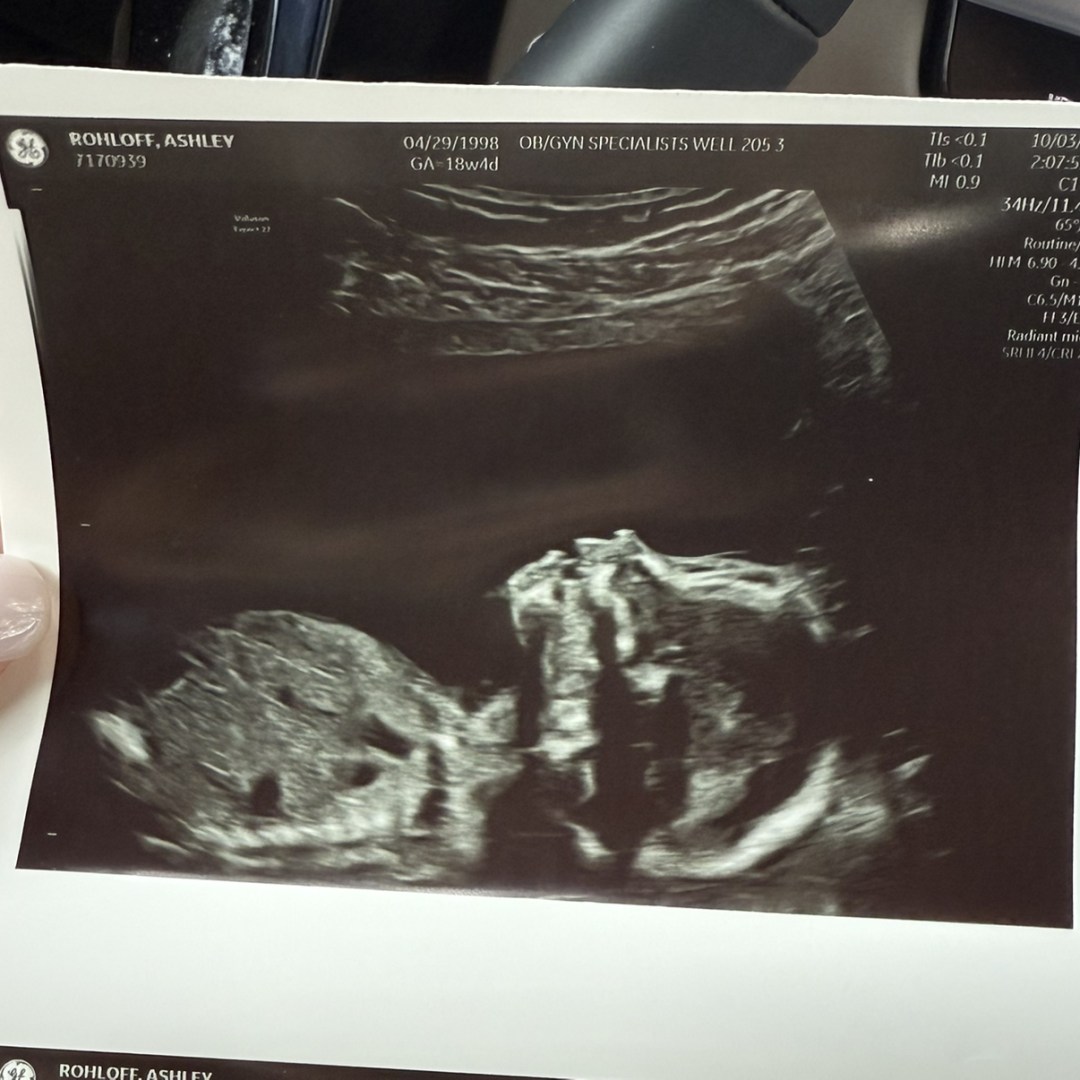 Photo shared by Ashley for their Babylist baby registry.