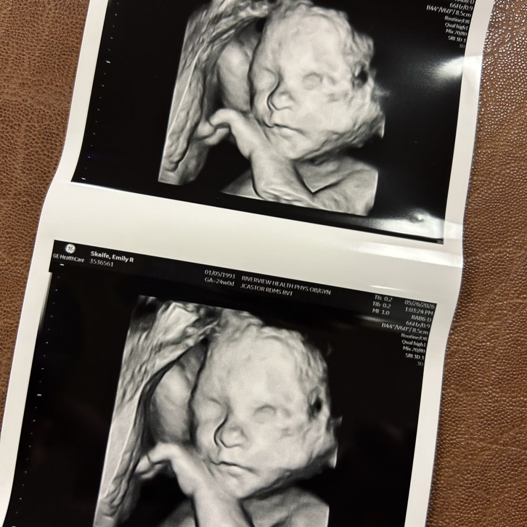 Photo shared by Emily for their Babylist baby registry.