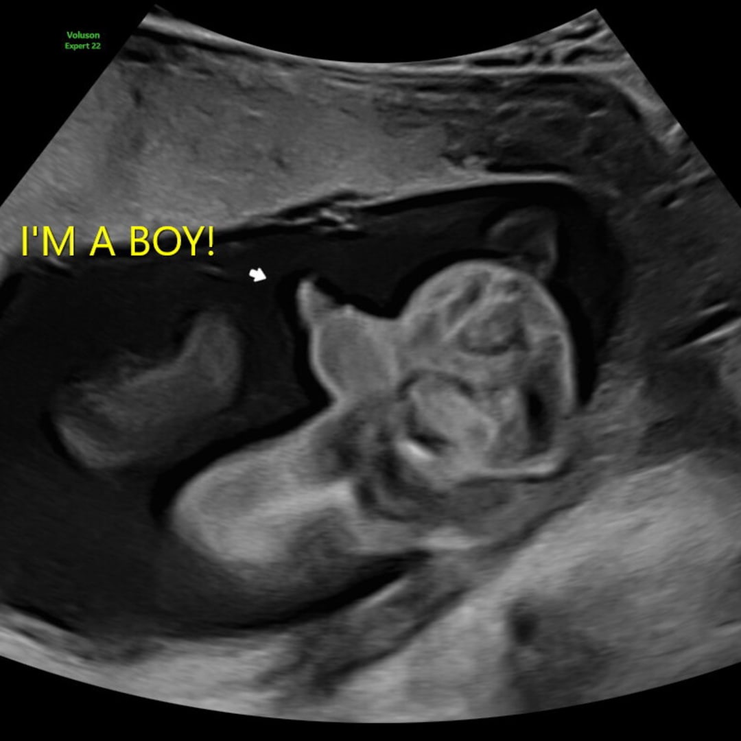 Photo shared by Raely for their Babylist baby registry.