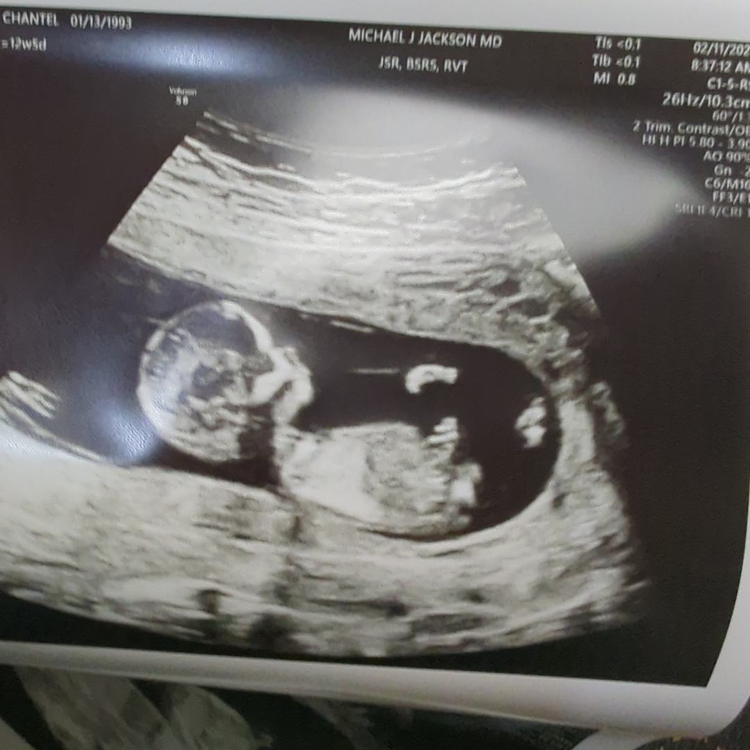 Photo shared by Chantel for their Babylist baby registry.
