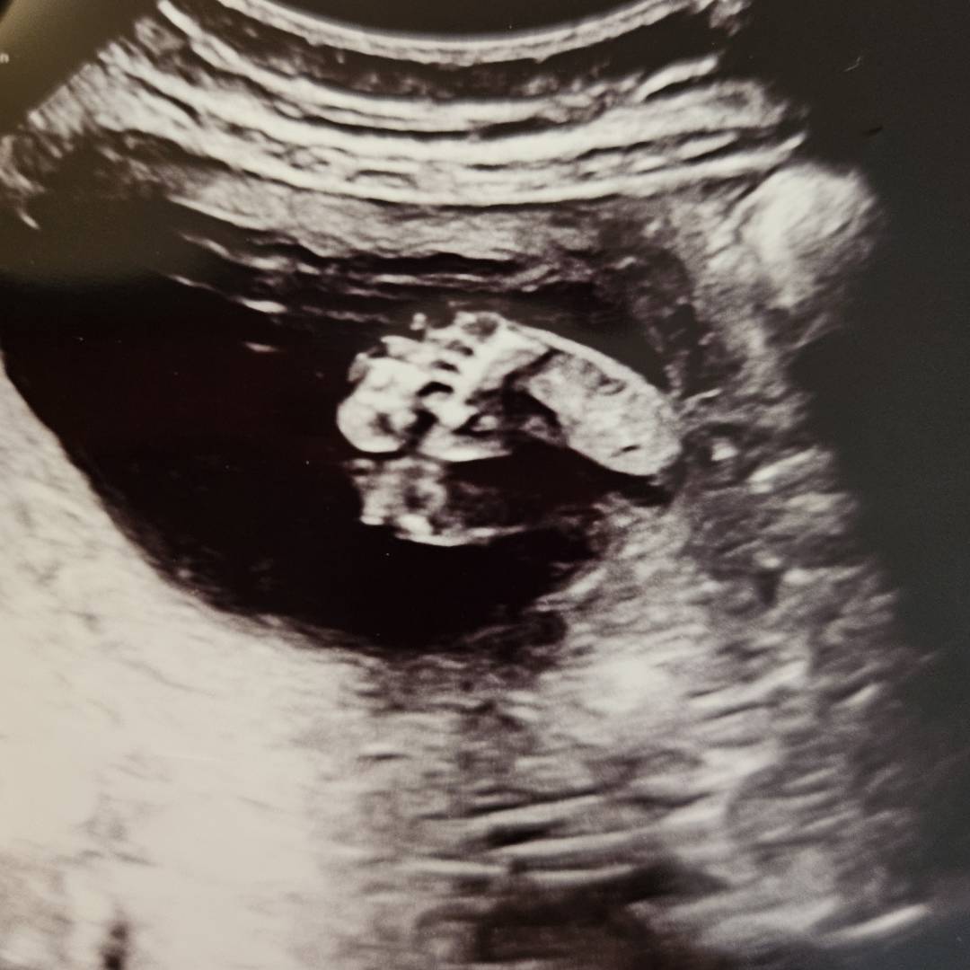 Photo shared by Kaya for their Babylist baby registry.