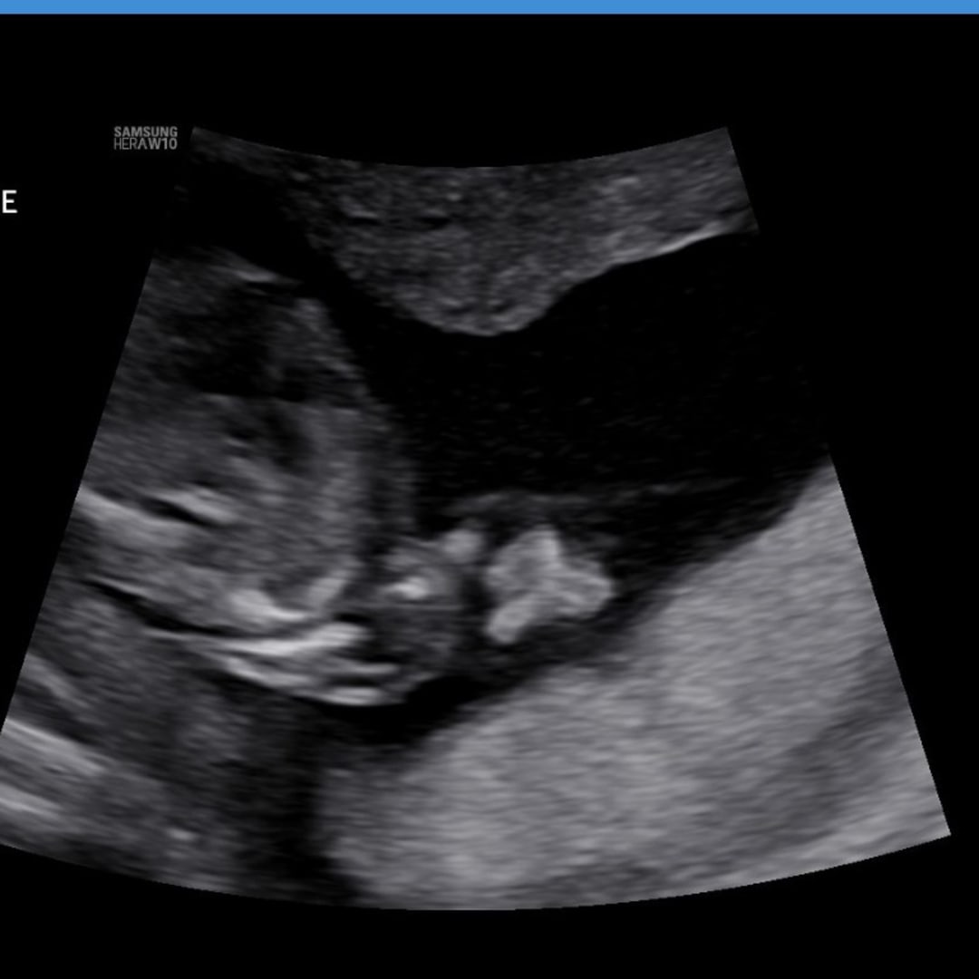 Photo shared by Raina for their Babylist baby registry.