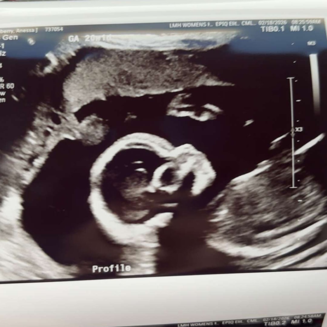 Photo shared by Anessa for their Babylist baby registry.