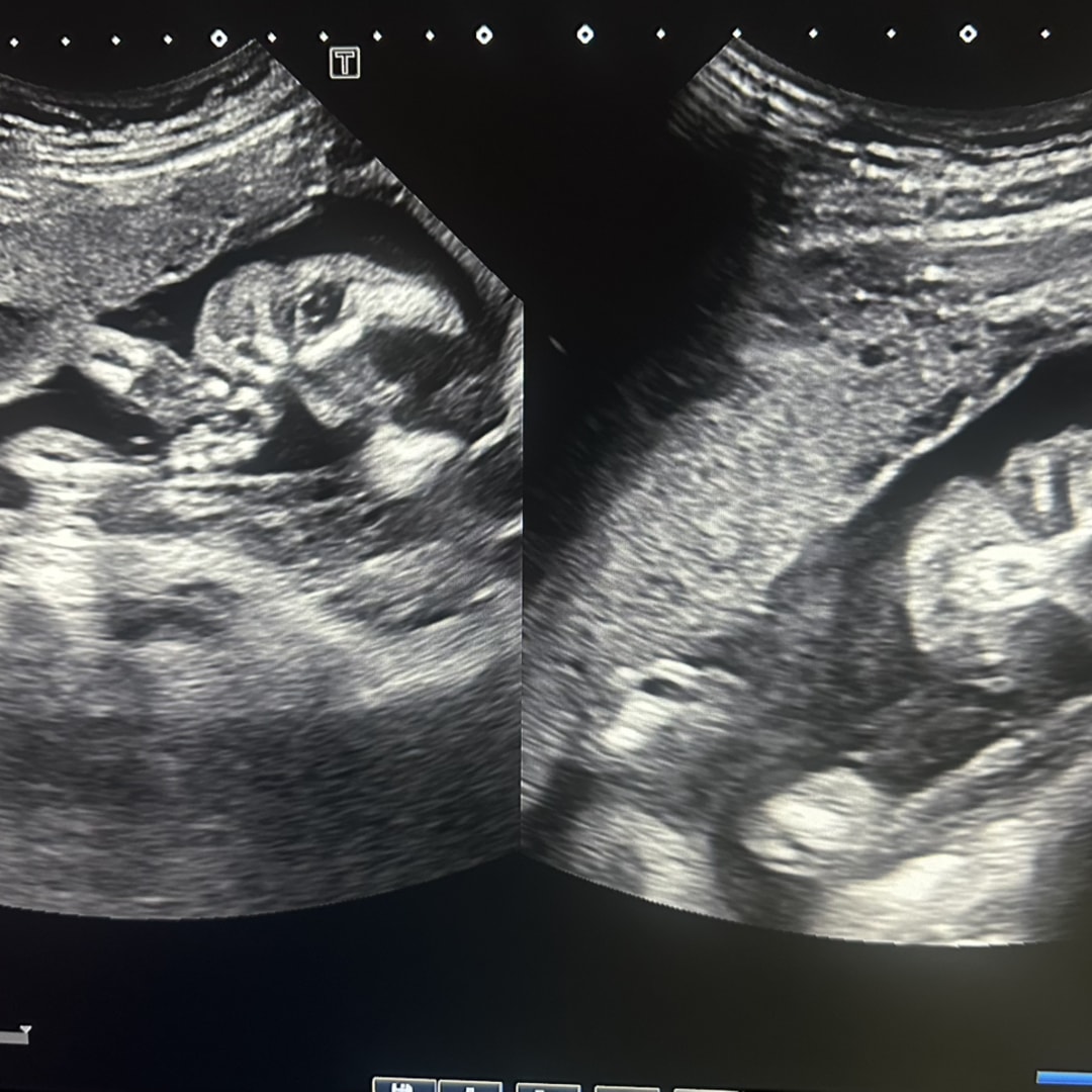 Photo shared by Melissa for their Babylist baby registry.