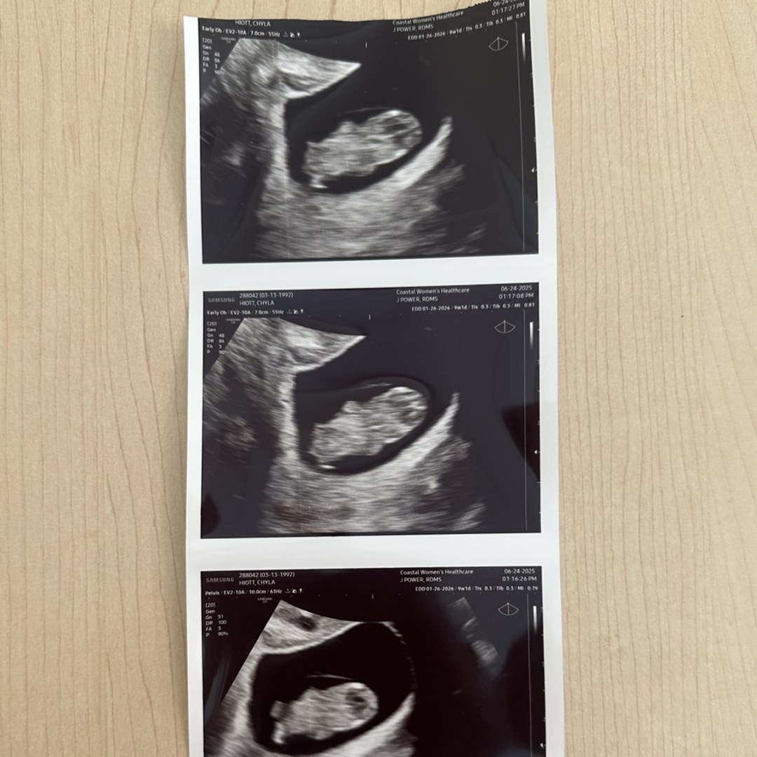 Photo shared by Chyla for their Babylist baby registry.