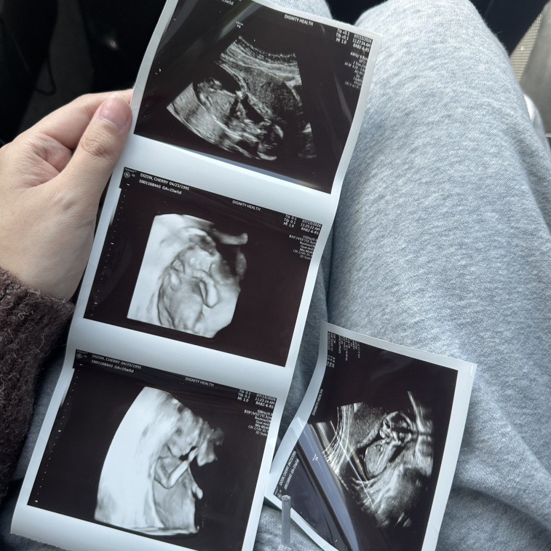 Photo shared by Cherry Ann for their Babylist baby registry.
