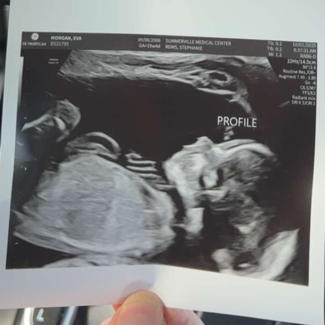 Photo shared by Eva for their Babylist baby registry.