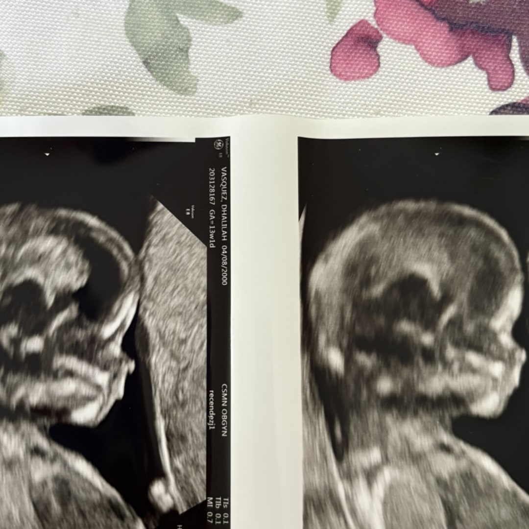Photo shared by Dhalilah for their Babylist baby registry.