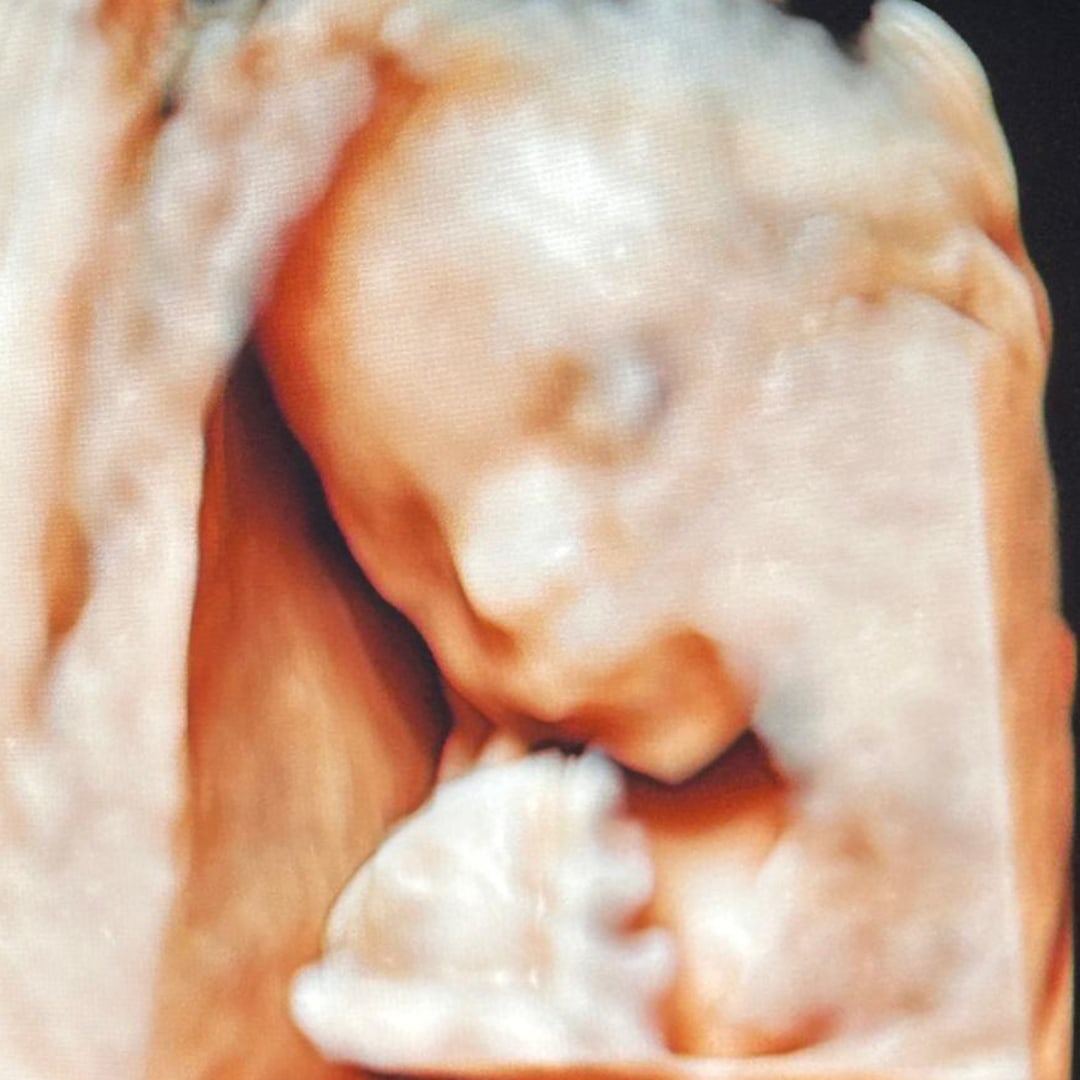 Photo shared by Karla for their Babylist baby registry.