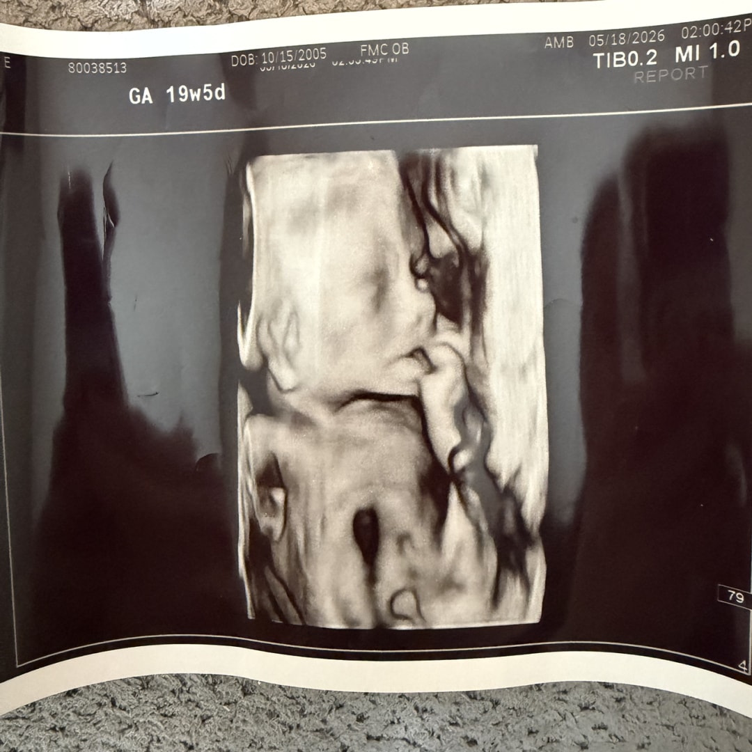 Photo shared by Hope for their Babylist baby registry.
