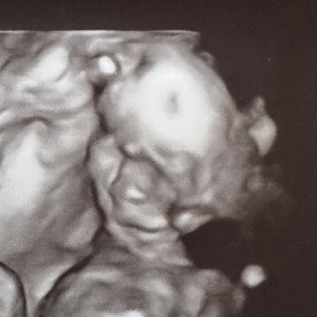 Photo shared by Nataliya for their Babylist baby registry.