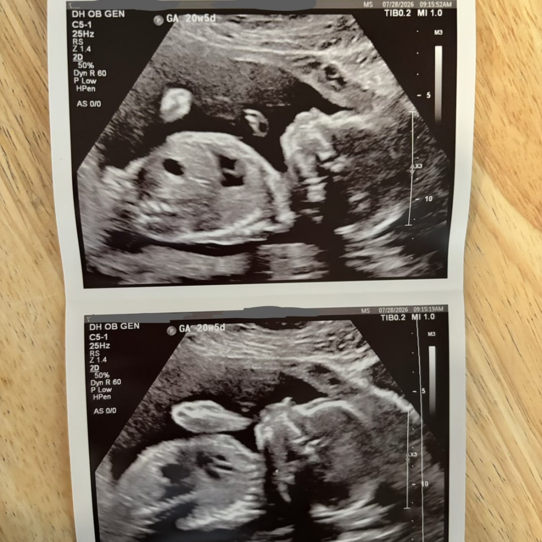 Photo shared by Brittany for their Babylist baby registry.